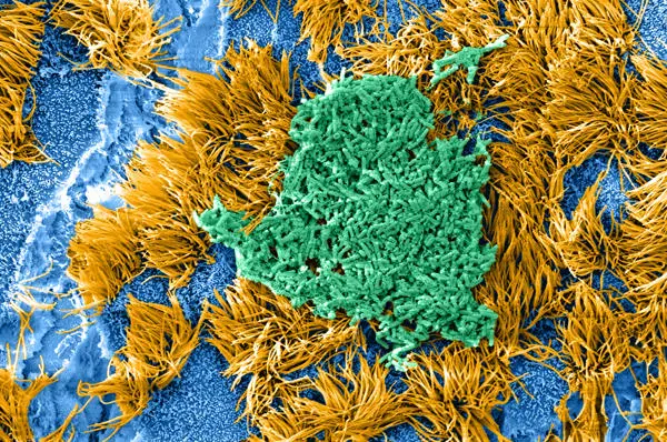 biofilm