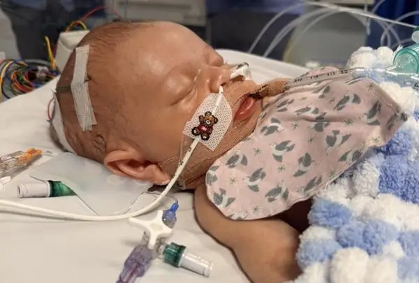 Leo in intensive care