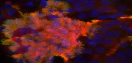 Ciliated airway cells