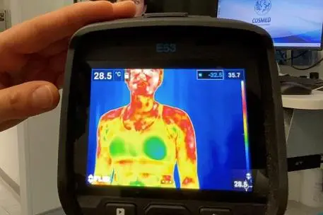 Thermal imaging device showing sweat output
