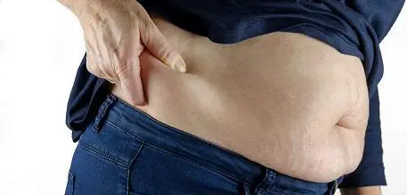 Overweight person pinching belly