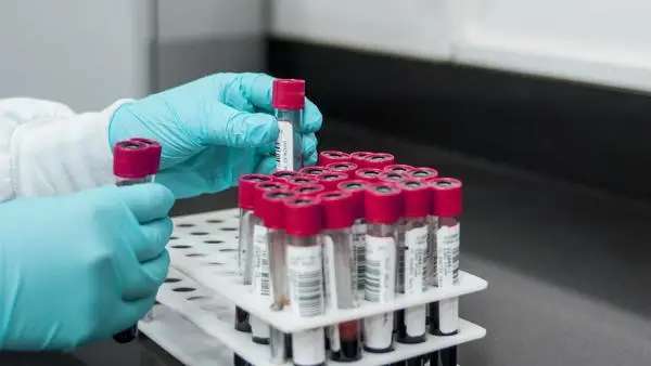 Lab