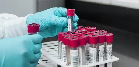 Gloved hands holding test tubes