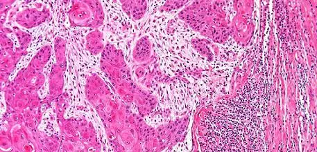 Cells under the microscope
