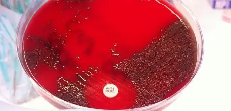 Petri dish