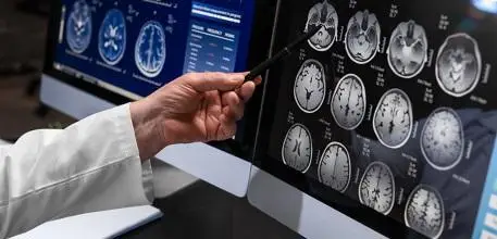 Person pointing at brain scan images on a computer screen